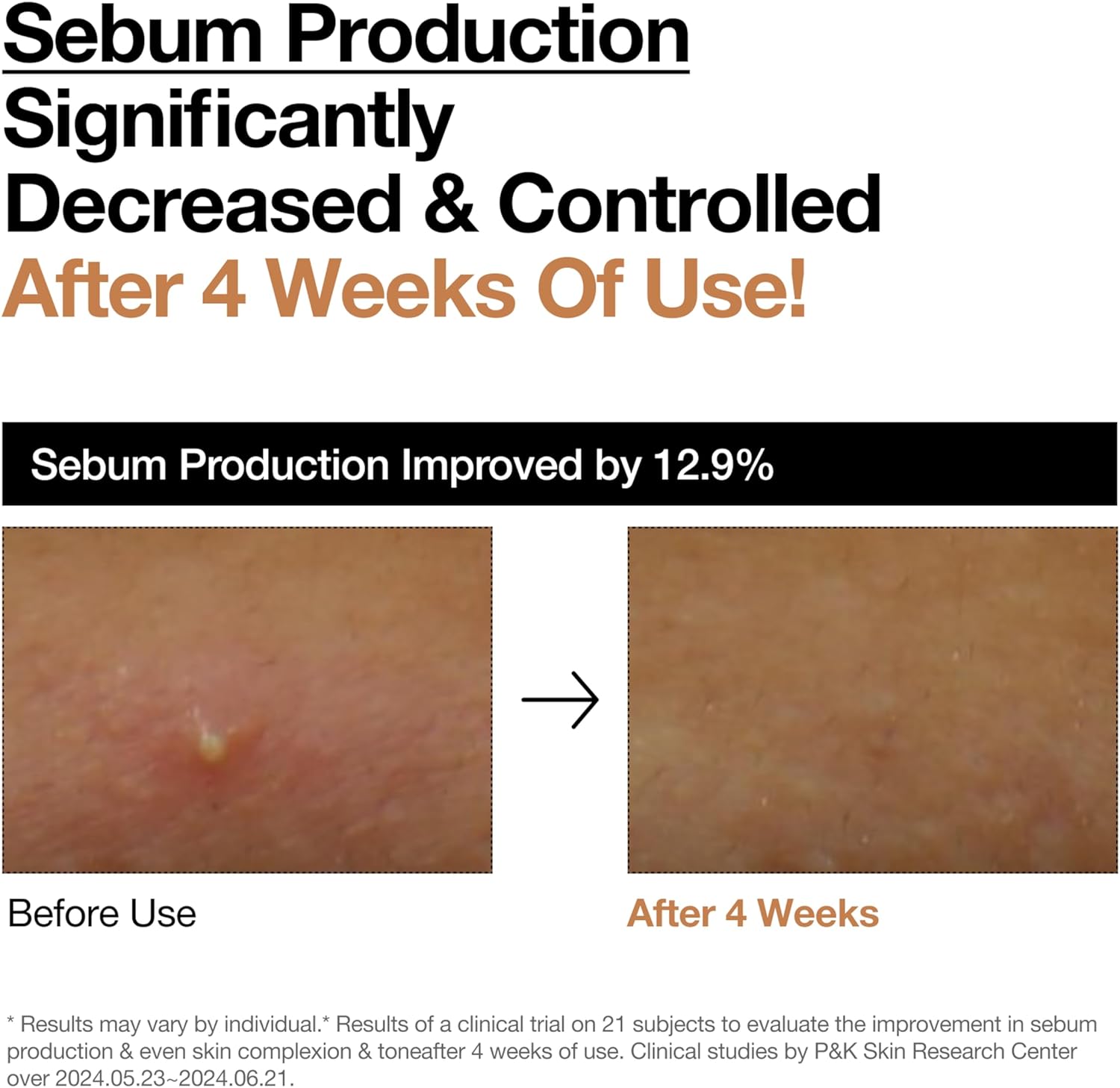 71lReG2SlXL._AC_SL1500_ 71lReG2SlXL._AC_SL1500_