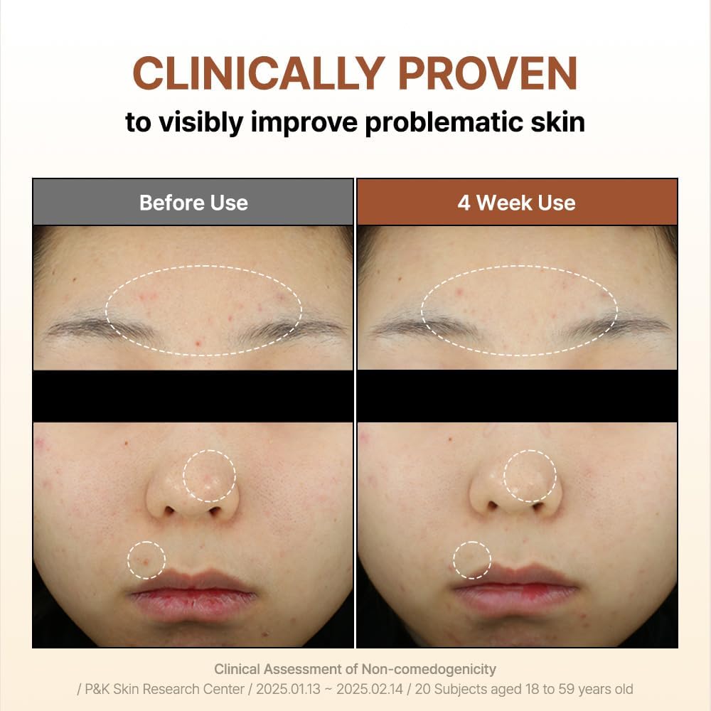 61sVGGB-+hL._AC_SL1000_ 61sVGGB-+hL._AC_SL1000_