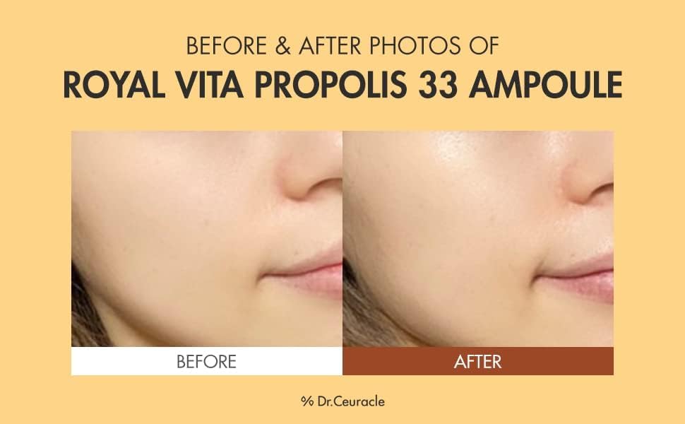 51UzViYyEcL._AC_ 51UzViYyEcL._AC_