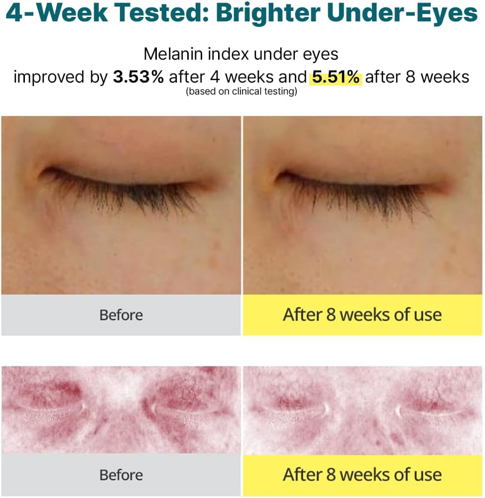 61sZCe4dlXL._AC_SL1200_ 61sZCe4dlXL._AC_SL1200_