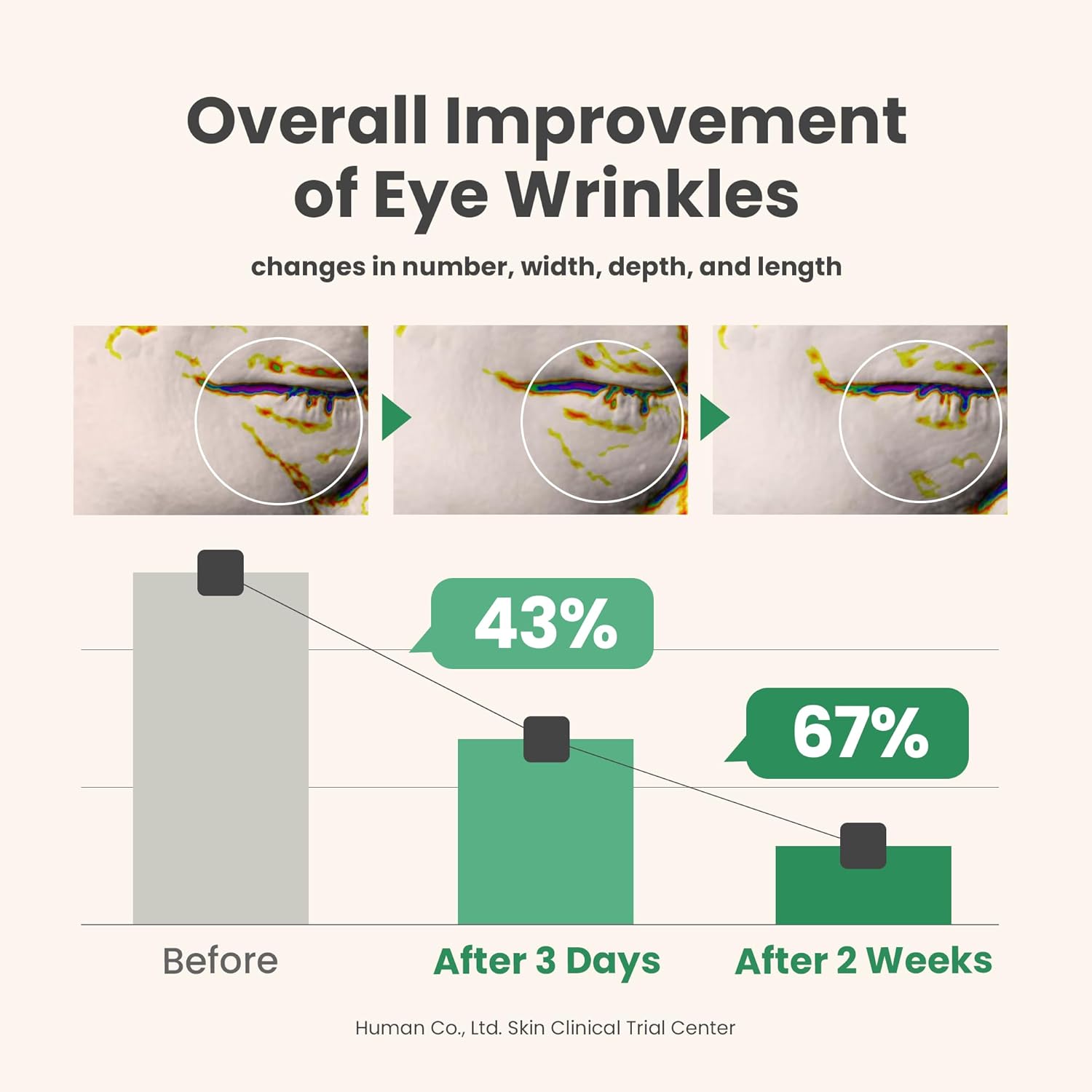 714pXJoV+2L._AC_SL1500_ 714pXJoV+2L._AC_SL1500_