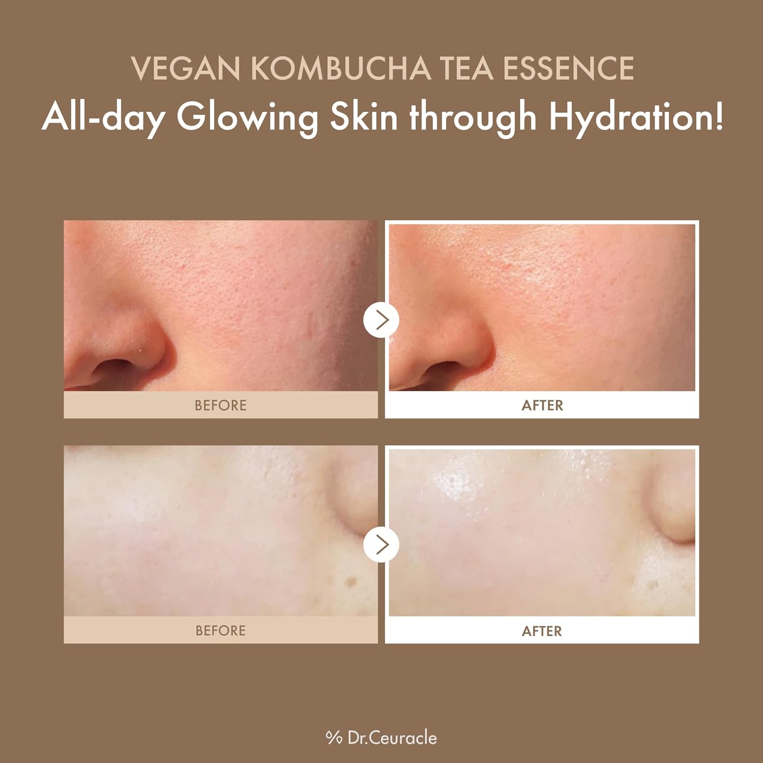 71BJNQTA6BL._AC_SL1500_ 71BJNQTA6BL._AC_SL1500_