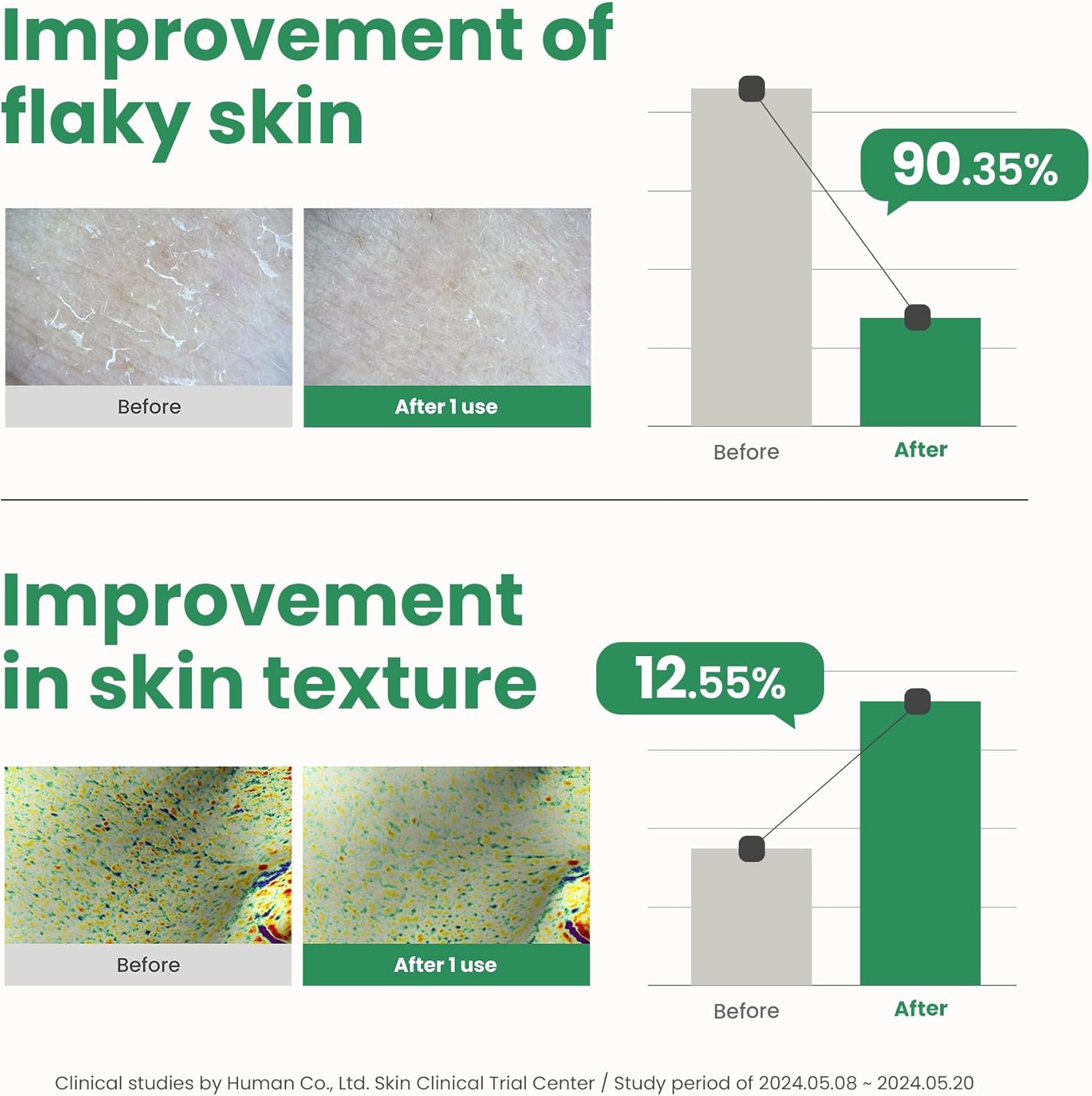 71nAtMAtDAL._AC_SL1500_ 71nAtMAtDAL._AC_SL1500_