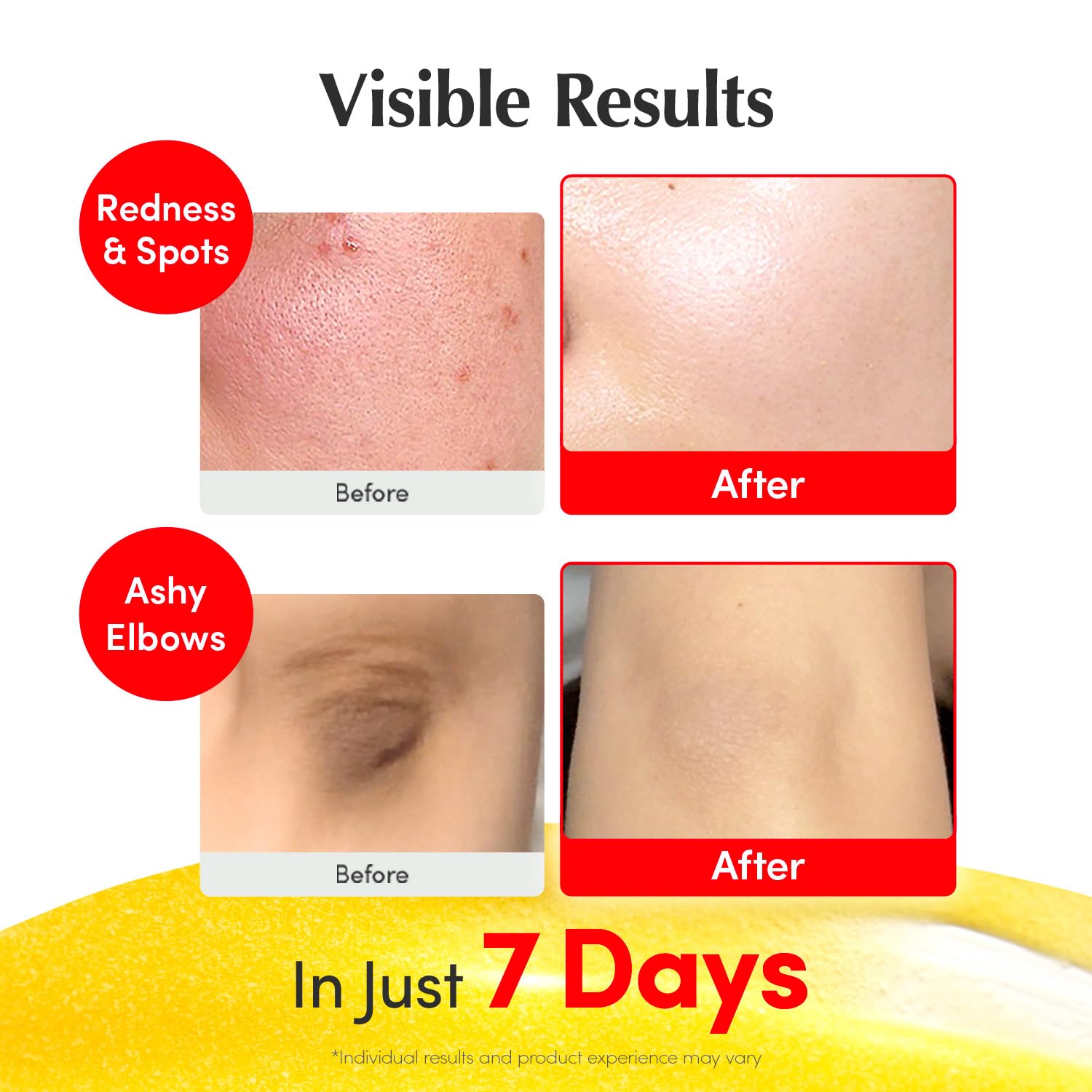 71BmMnxG3wL._SL1500_ 71BmMnxG3wL._SL1500_