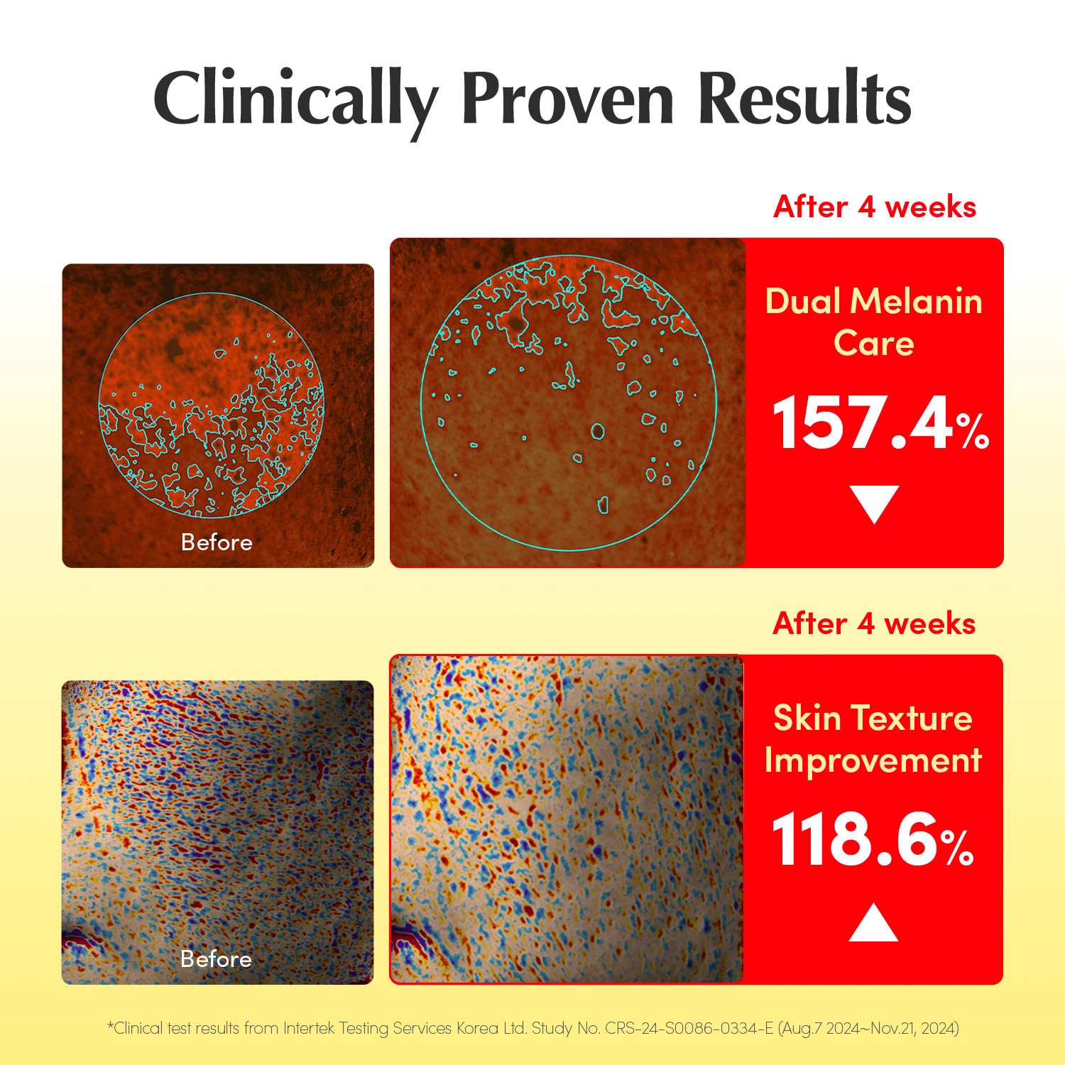 71VSvStetFL._SL1500_ 71VSvStetFL._SL1500_