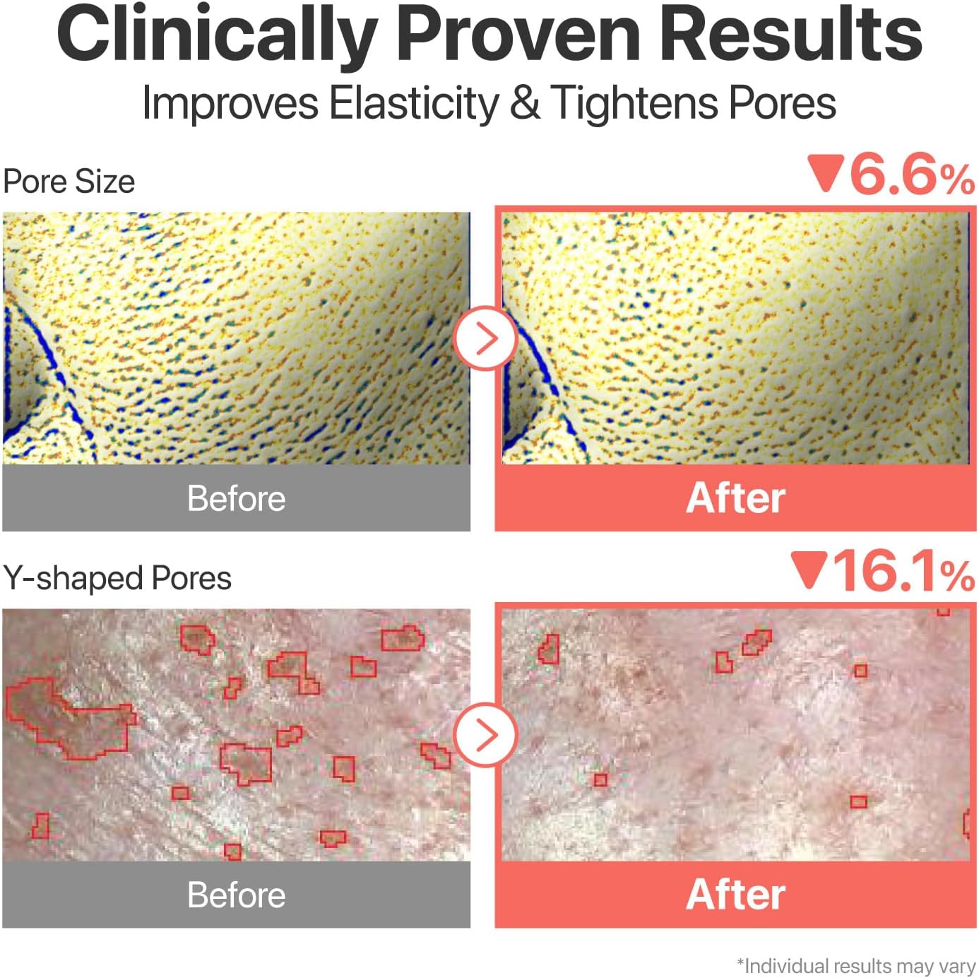 71Ccq3nUtbL._AC_SL1500_ 71Ccq3nUtbL._AC_SL1500_